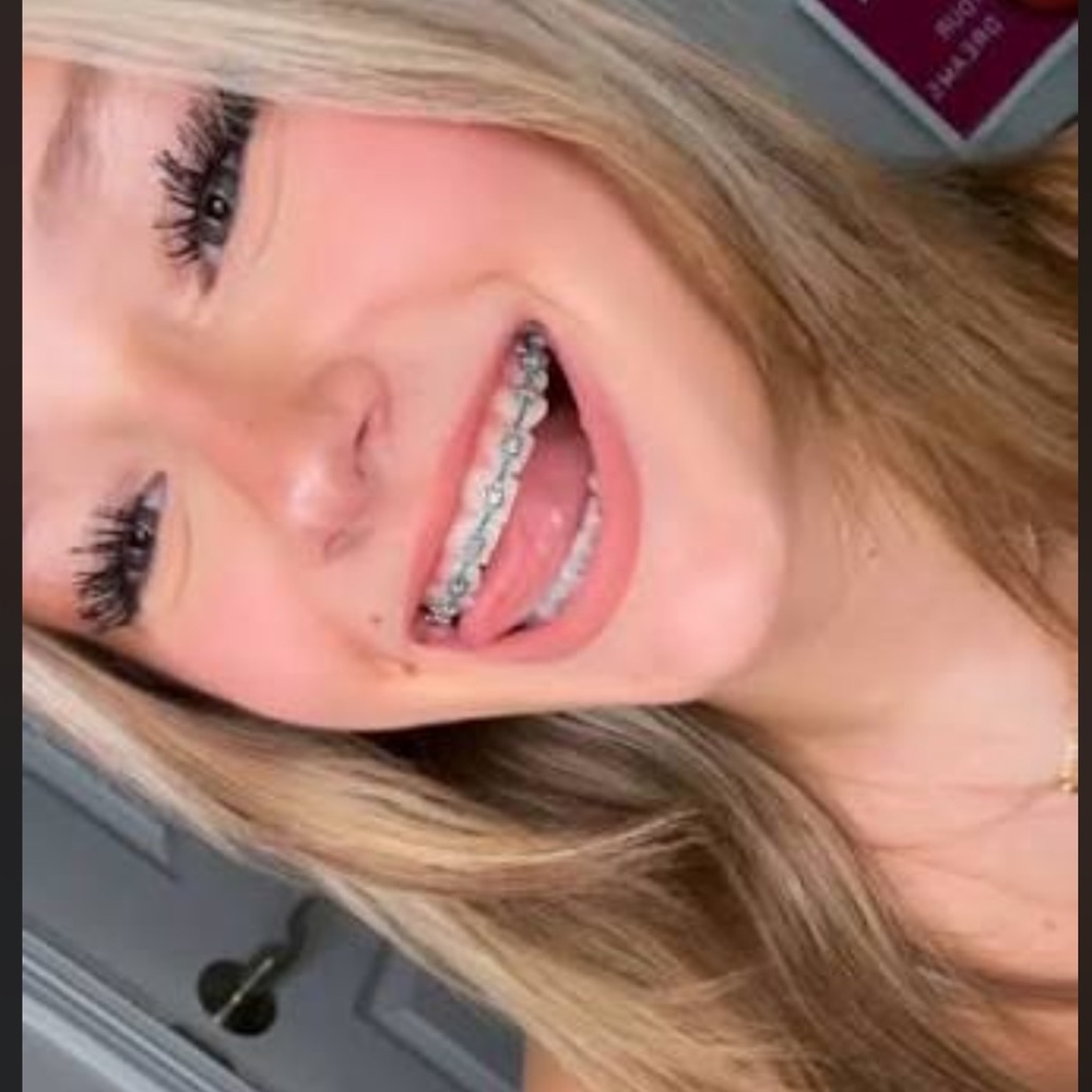 Meet your Posher, anon